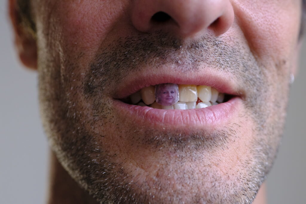 André Fortino, Maman sur ma dent, Photographie